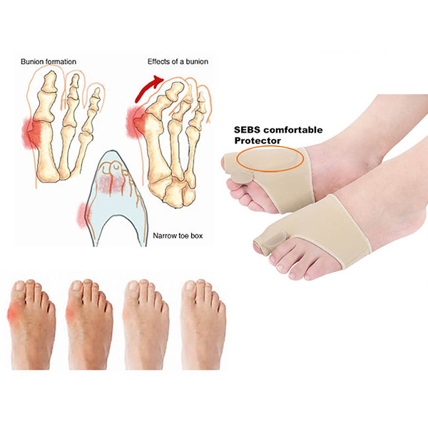 Masaje nuevo,dedos grandes para proteger la camilla,prótesis ortopédicas para voltear el dedo pulgar.